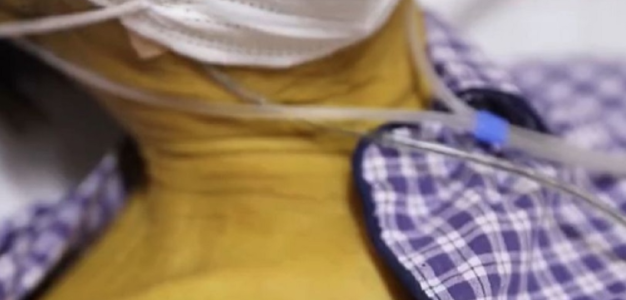 Uomo diventa giallo e va in ospedale: ciò che scoprono i medici è incredibile
