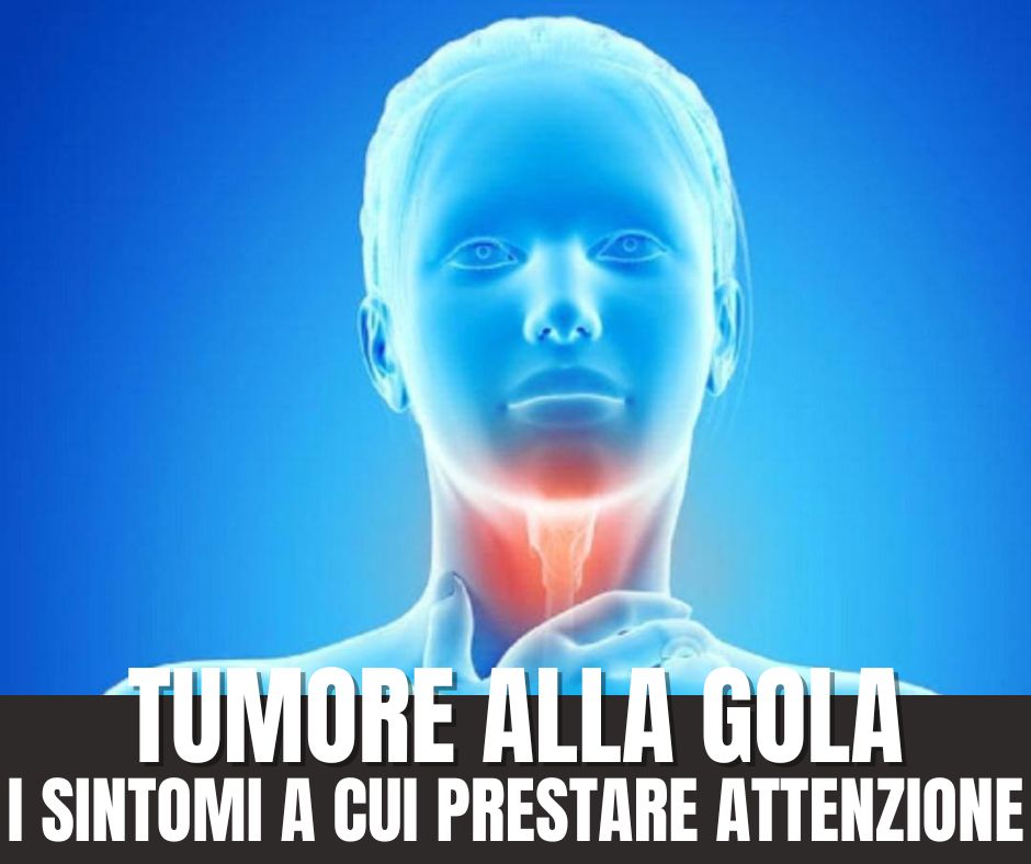 Tumore Alla Gola E Alla Laringe Quali Sono I Sintomi A Cui Prestare